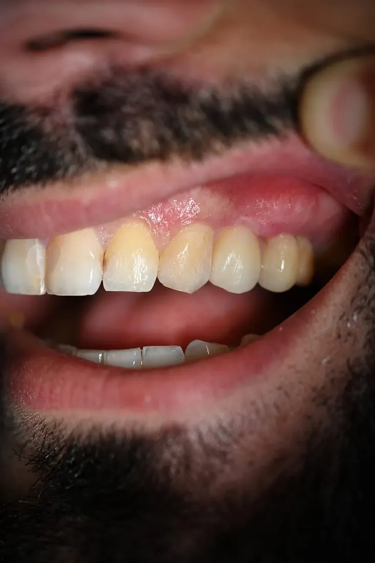 Cas 2 — Résultat
