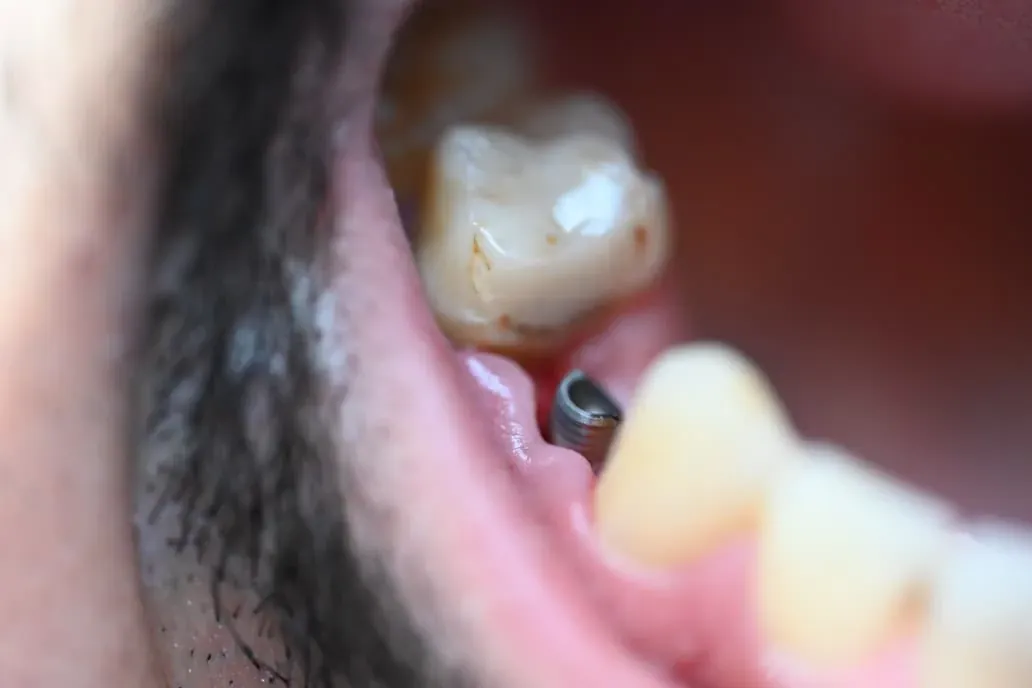 Cas 2 — Étape clinique
