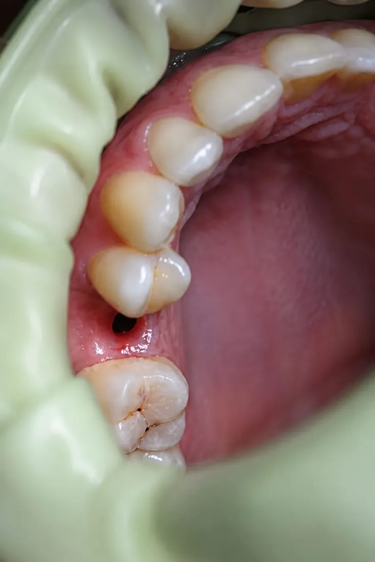 Cas 3 — Étape clinique 1