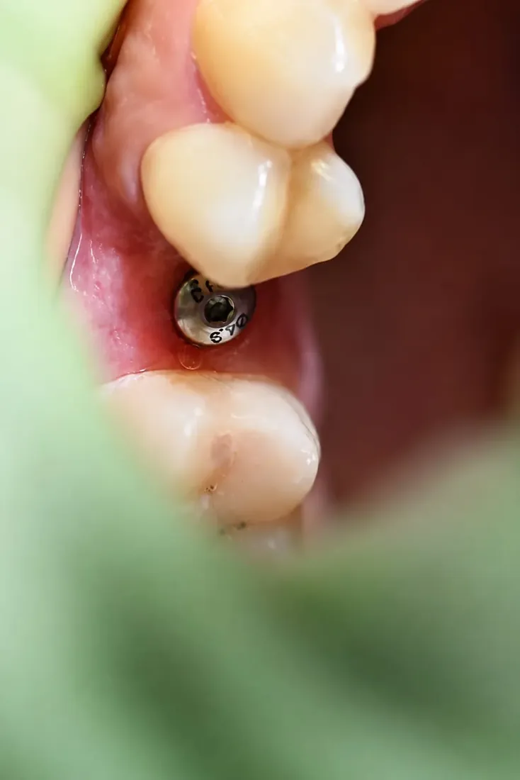 Cas 3 — Étape clinique 2